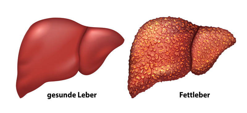 Gesund vs fettleber